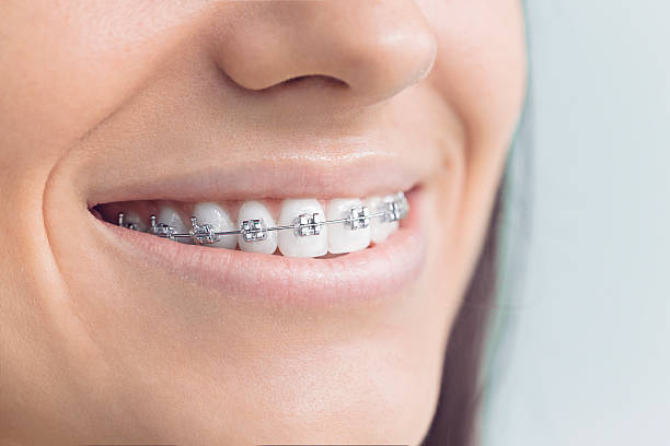 Best Periodontal (Gum) Disease Treatment  in Deridder, LA